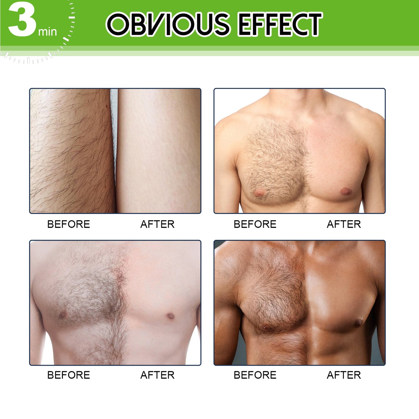 East Moon Hair Removal Cream