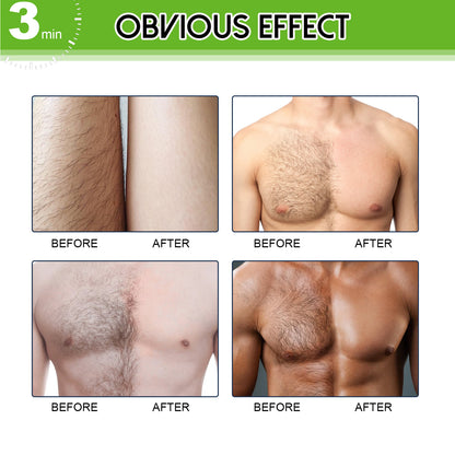 East Moon Hair Removal Cream
